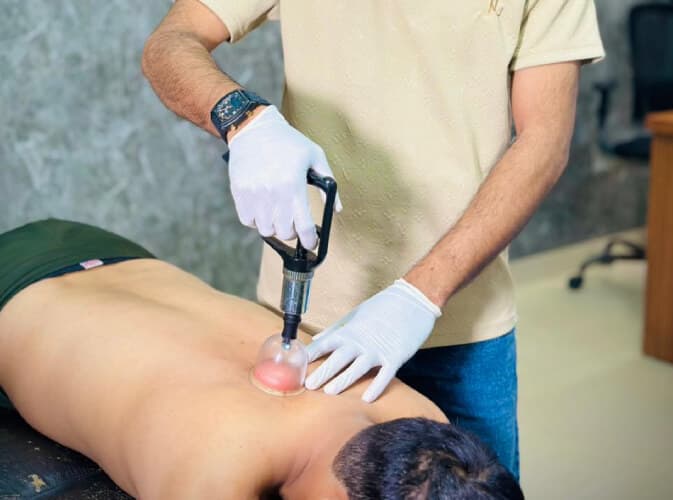 best cupping therapy clinic in india